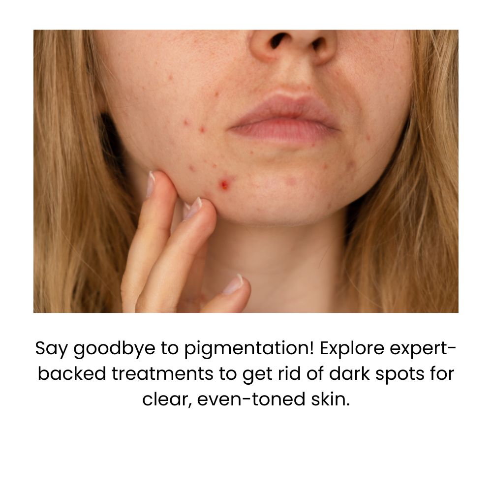 Woman’s face showing dark spots before and after skin treatment.